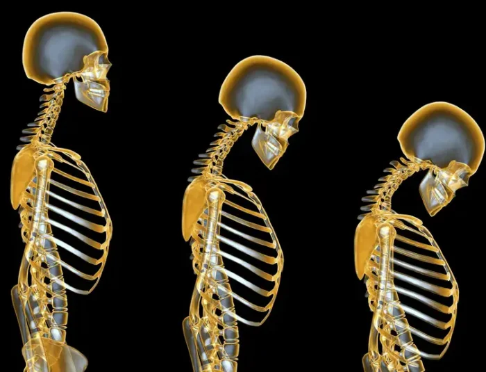 Peningkatan Kesehatan Tulang