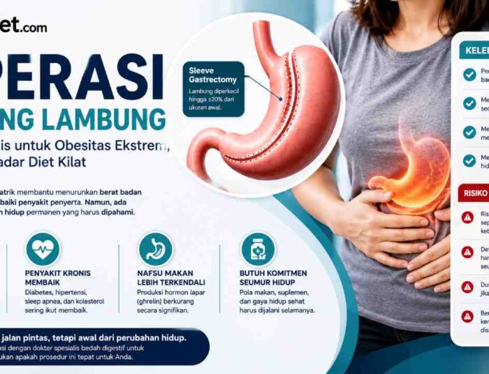 Operasi Potong Lambung Diet Instan, Risiko yang Jarang Disadari
